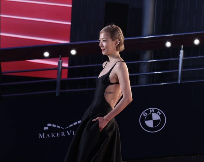 郑秀文夺后双臂被打码 网酸“好像被截肢”