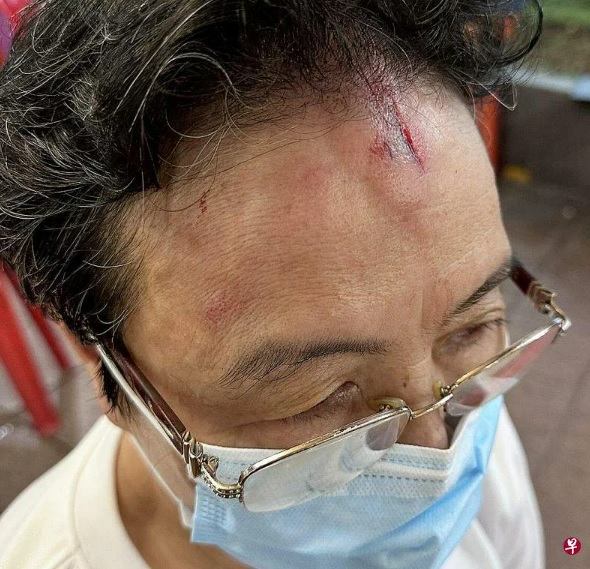 （已签发）柔：狮城二三事：咖啡店地板不平 七旬妇绊倒跌破头