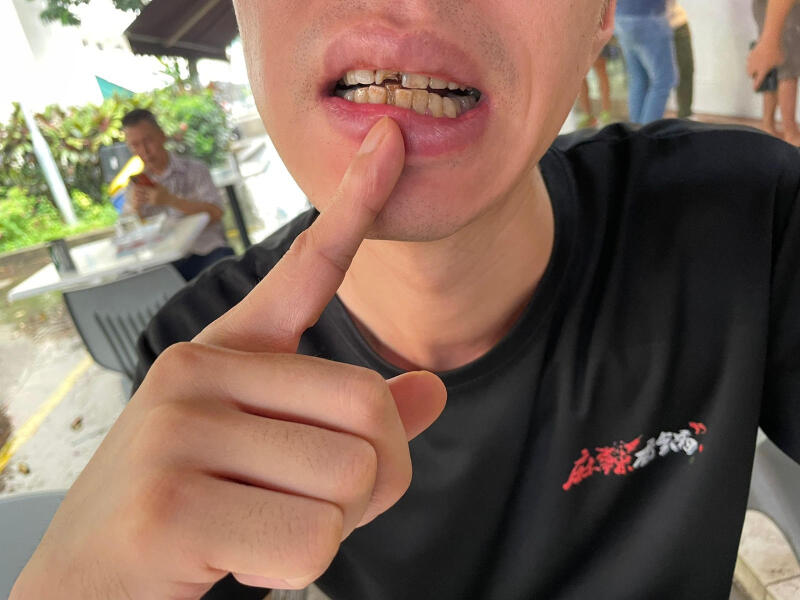 (已签发)柔:狮城二三事:麻辣香锅厨师 挥刀恐吓杀经理 泼鱼汤打断牙