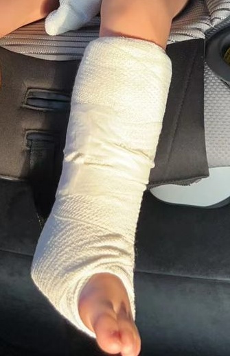 （未签发）全国：45岁养殖业者申诉托儿所教师致伤2岁儿骨裂