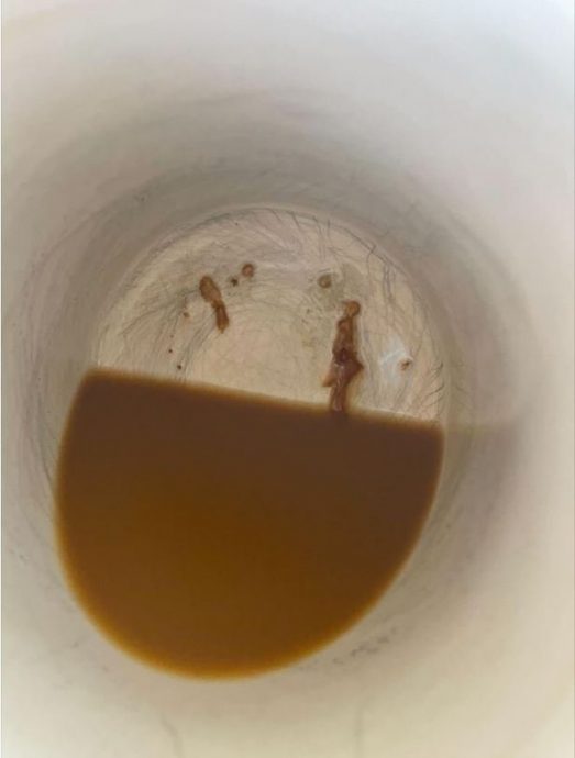 咖啡有异常“咸味”  始揭医生多次炮制精液咖啡