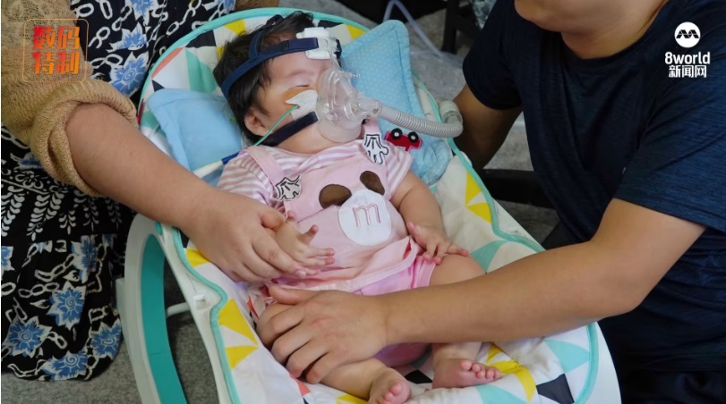 (已签发)柔:狮城二三事:28周早产儿患遗传病 父母负债累累救“奇迹女儿”