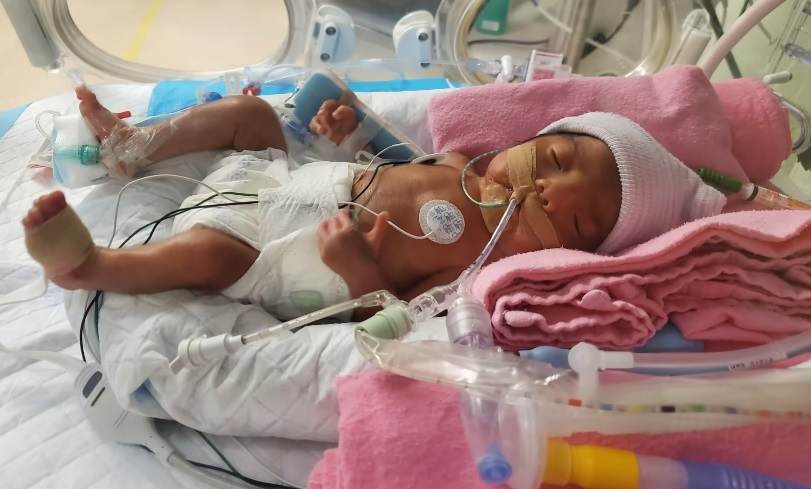 (已签发)柔:狮城二三事:28周早产儿患遗传病 父母负债累累救“奇迹女儿”