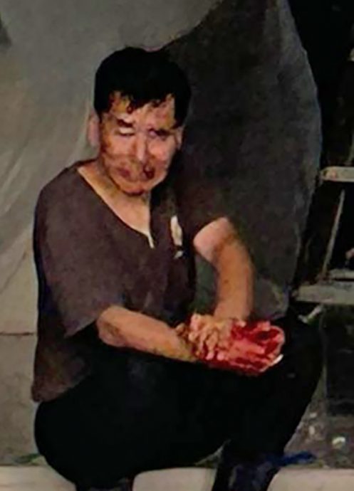 (已签发)柔:狮城二三事:眼镜店玻璃爆裂伤5人 一人动脉破喷血