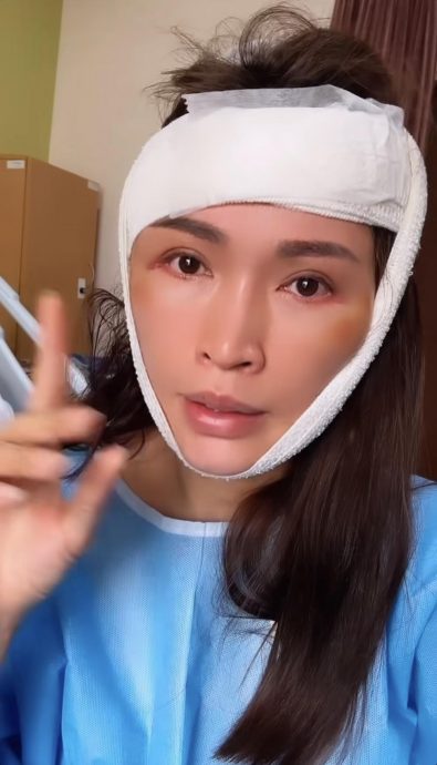 Amber Chia晕倒撞到头 入院急动手术 