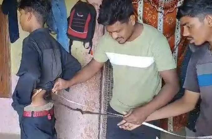 少年背上长出“60公分尾巴”照片曝光! 村民超惊讶:是猴神