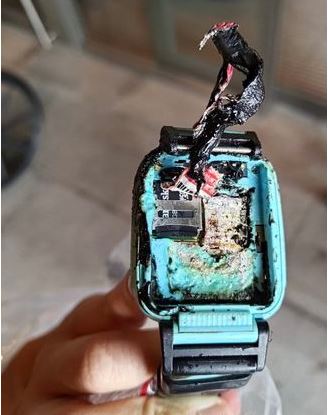 智能手表爆炸自燃 台10岁童炸伤或需植皮
