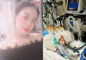 正妹隆鼻手术惨丧命！离谱诊所“连夜改名”继续营业