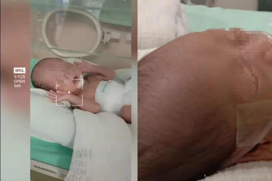 母亲指控护士疏忽 宝宝护士手中掉落 脑出血骨裂