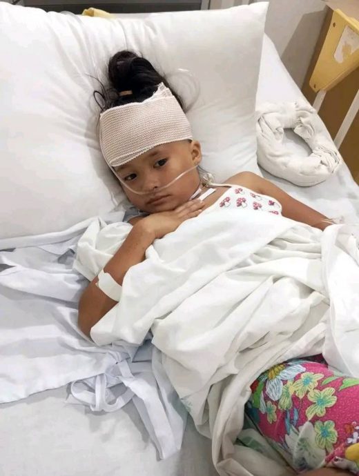 没钱付手术费 剪刀插头一周 女童奇迹活命