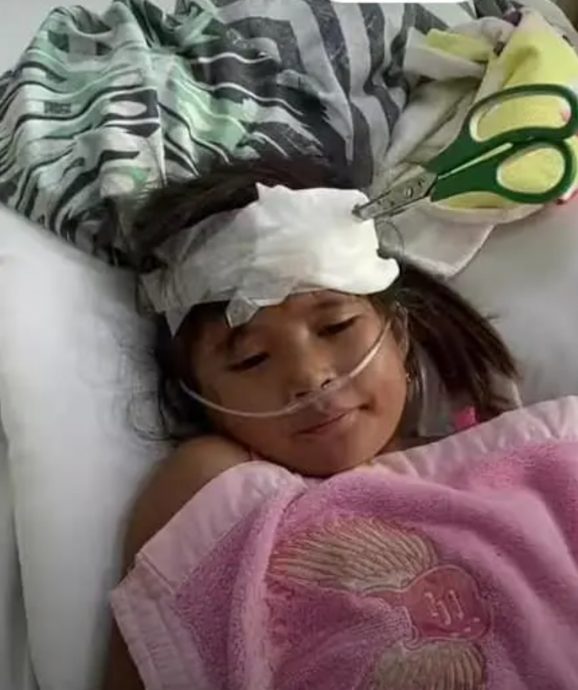 没钱付手术费 剪刀插头一周 女童奇迹活命