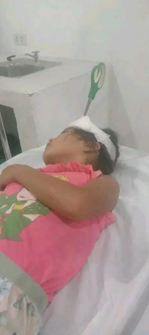 没钱付手术费 剪刀插头一周 女童奇迹活命