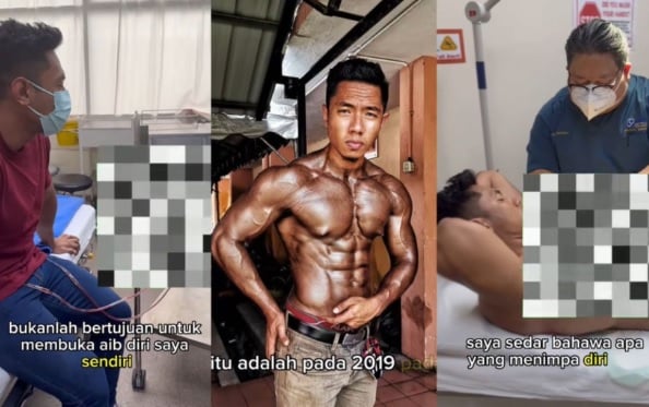  男子为健美吃类固醇  “乳房变大须切除”