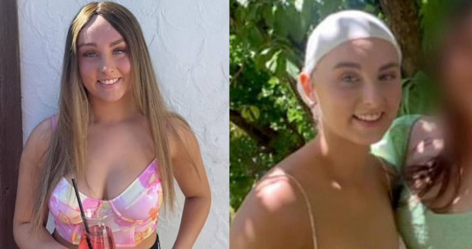 英国少女澳洲打工头发卷入机器扯甩头皮 法院罚饮料厂37万