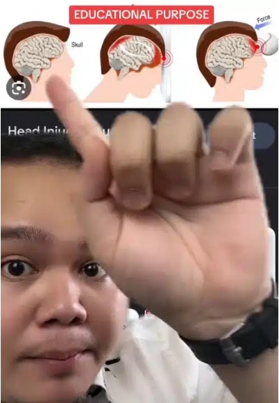 视频|女子摔跤敲头晕倒抽搐 医生:心肺复苏救了她