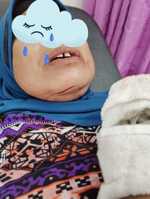 (已签发)柔:匪徒白天持巴冷刀闯入室,割伤妇女抢走金手链