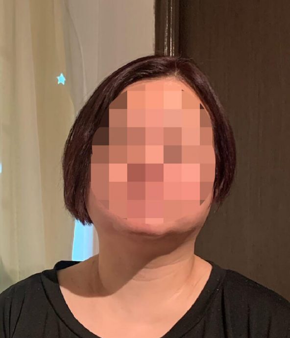 (已签发)柔:狮城二三事:妇女申诉被烫伤发型如狗咬 发廊:已请她回来检查
