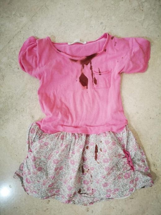(已签发)柔:狮城二三事:家养孔雀袭击女童 家人起诉主人获赔偿