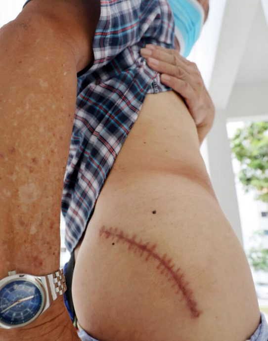 (已签发)柔:狮城二三事:怕乌鸦再袭慌逃 车长摔倒髋骨裂