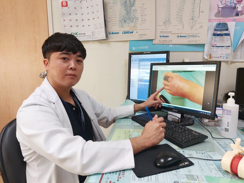 出国度假小伤口接触海水 妇人脚趾坏死截断求生