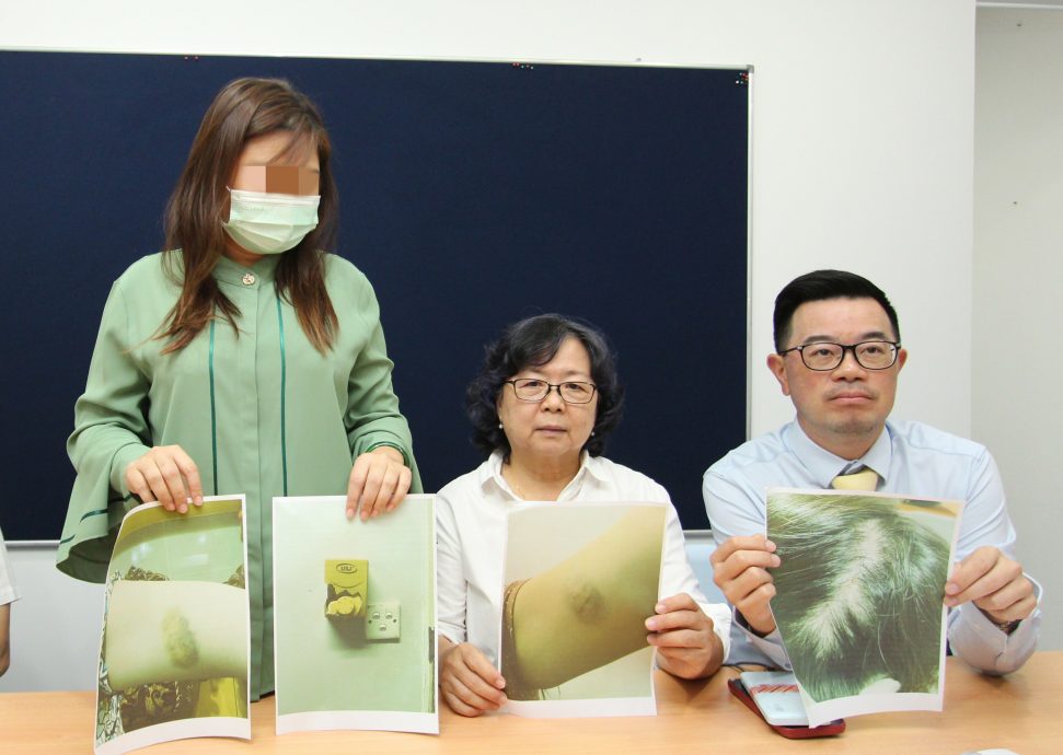 女商人控诉拿督丈夫家暴 “怀孕初期仍打我”