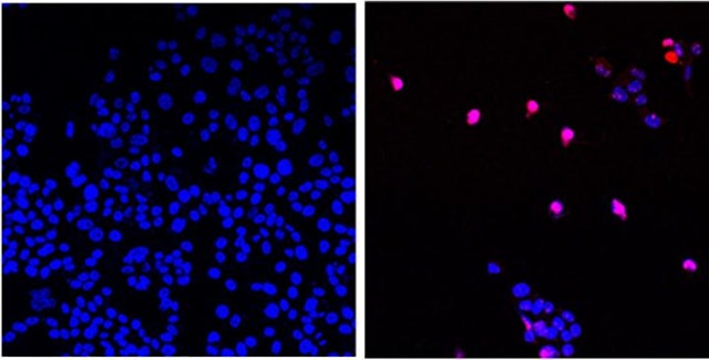 拚盘)能杀死70多种肿瘤细胞　美国AOH1996有望成有效治癌新药