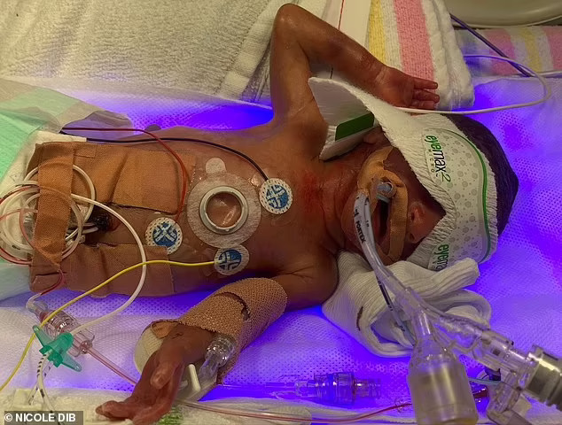 拼盘 母亲拒绝停止生命维持装置五次 25周早产儿子奇迹般存活