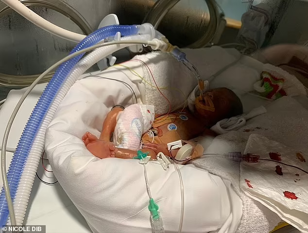 拼盘 母亲拒绝停止生命维持装置五次 25周早产儿子奇迹般存活