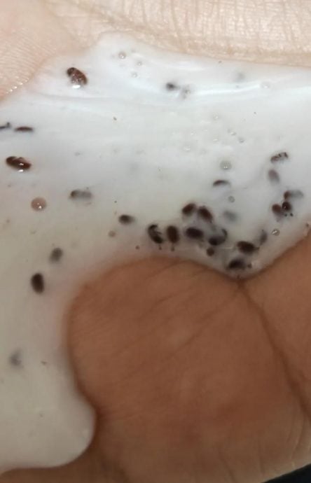 拼盘/洗发精一压50多只虫卵…她曝1关键点崩溃了:苦主恐一票人