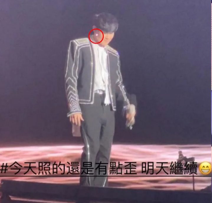 林俊杰开唱遭雷射笔攻击 黑粉撂话“照瞎他”