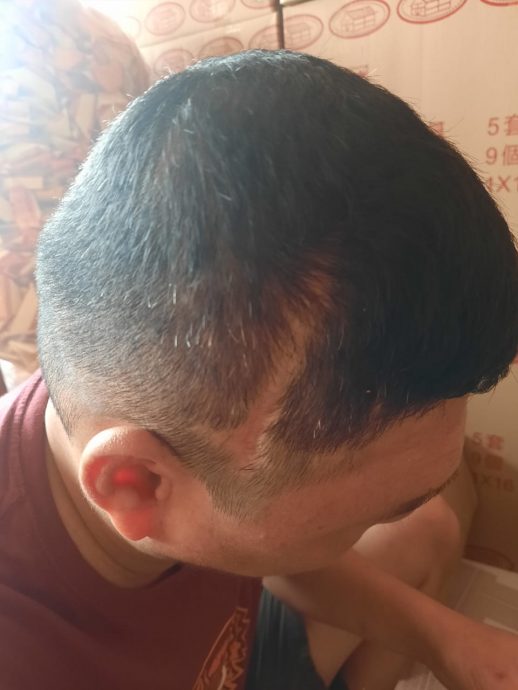 柔:星洲基金(8月23日刊):颜师木一家情况未见改善,需各界再伸援手