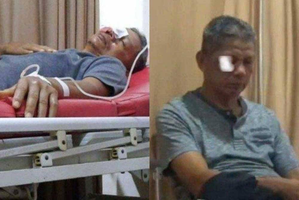 气愤老师打儿子 父亲弹弓致瞎老师后逃跑