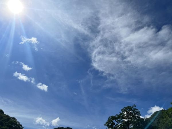 王心凌自爆动手术 31天塞56个行程忙翻