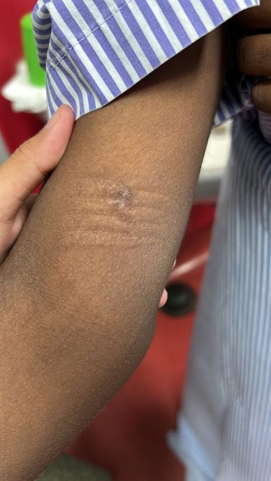 疑被虐待,12岁女童报警抓亲妈!