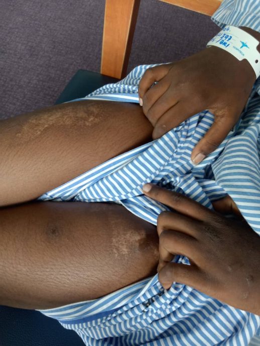 疑被虐待,12岁女童报警抓亲妈!