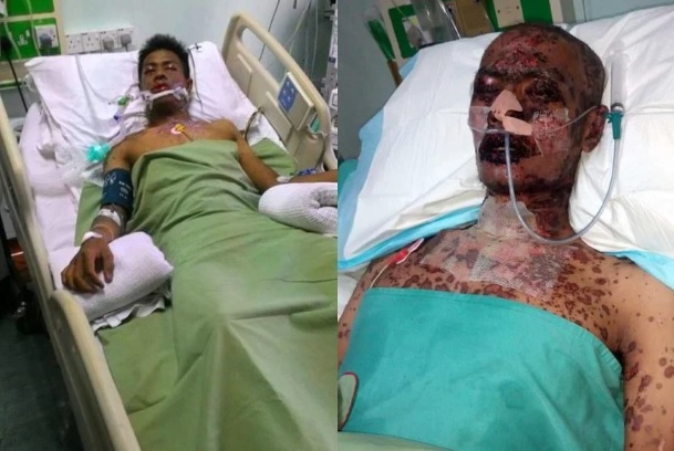  男子药物过敏致视障  “突失明难过但感恩还活着”