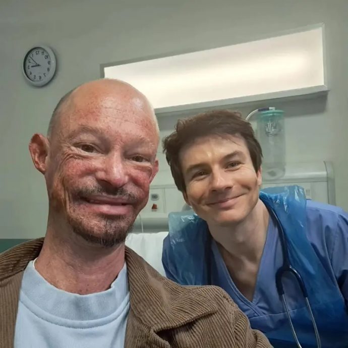 罹罕病不能晒太阳 《权力游戏》36岁男星骤逝