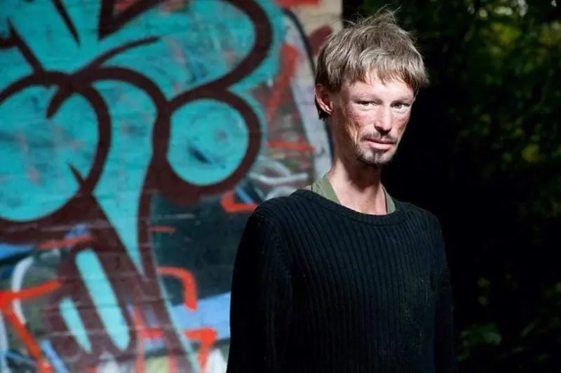 罹罕病不能晒太阳 《权力游戏》36岁男星骤逝