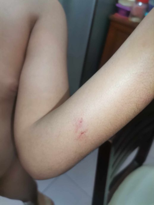 自闭儿疑在特殊学校遭虐待·母亲哑忍一年报警求助