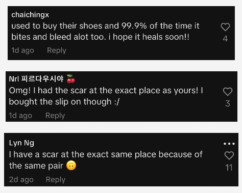 (已签发)柔:狮城二三事:穿新鞋起水泡 女子脚受感染发炎