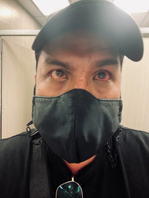 一觉醒来半脸麻痹  男子崩溃哭了 “吃一碗Maggi花1小时”