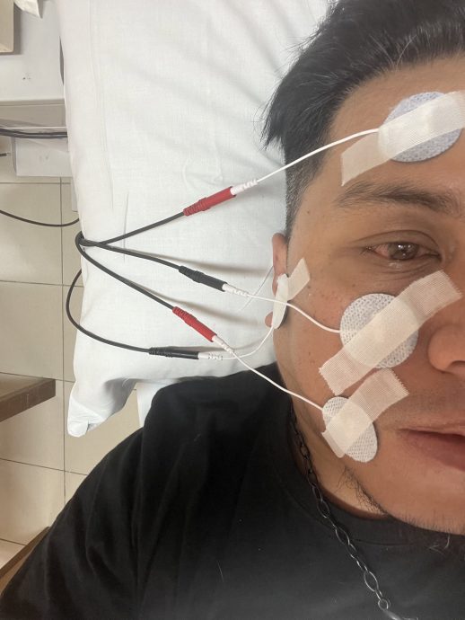 一觉醒来半脸麻痹  男子崩溃哭了 “吃一碗Maggi花1小时”