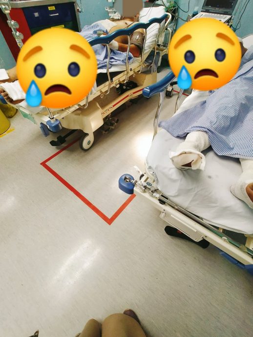 不知煤气软管破裂 孕妇煮食时被火烧伤手脚