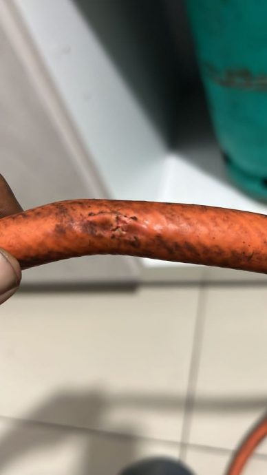 不知煤气软管破裂 孕妇煮食时被火烧伤手脚