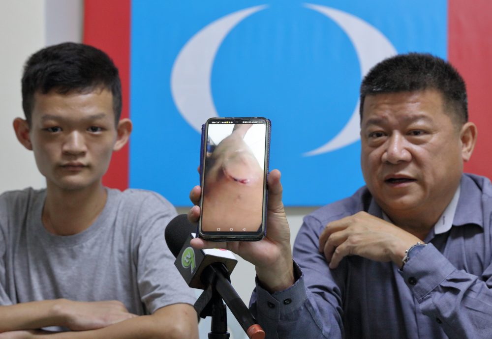 全国／缴3万5赎金反被转卖KK园区，青年不堪被虐以死威胁终获释。