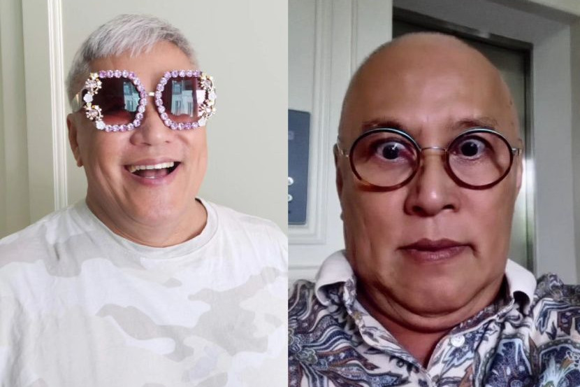 化疗导致脱发 旺师傅:最新形象 满满自信