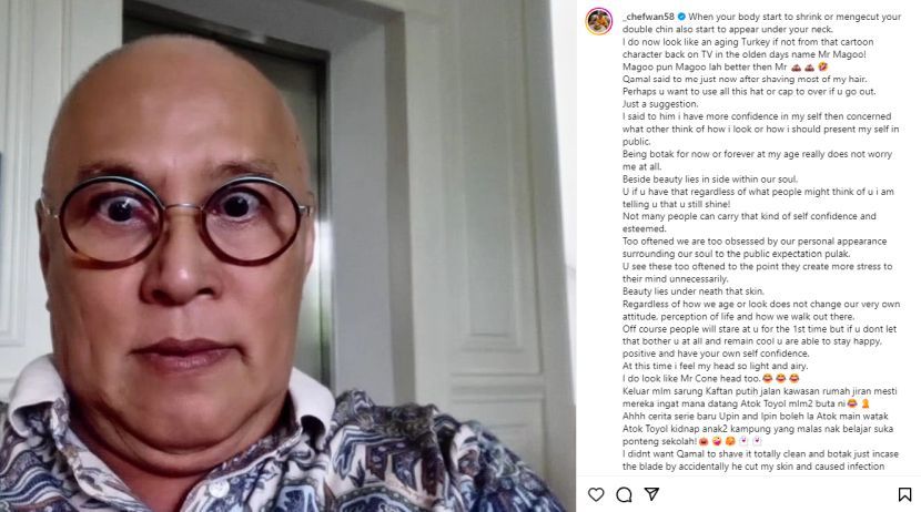 化疗导致脱发 旺师傅:最新形象 满满自信