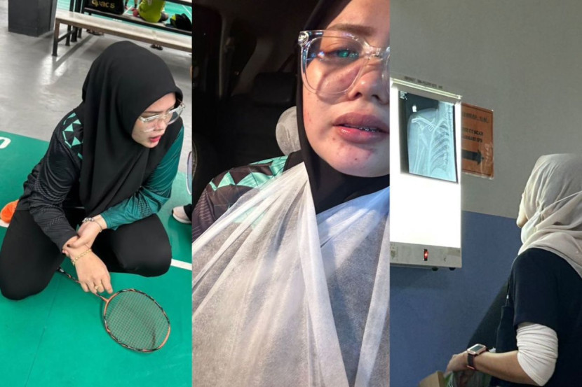 打羽球打到肩膀脱臼 女子：十级疼痛