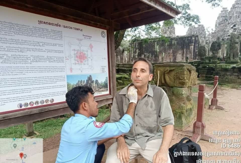 拼盘 2图  已签  吴哥窟猴子日益凶猛 游客受促别做这事