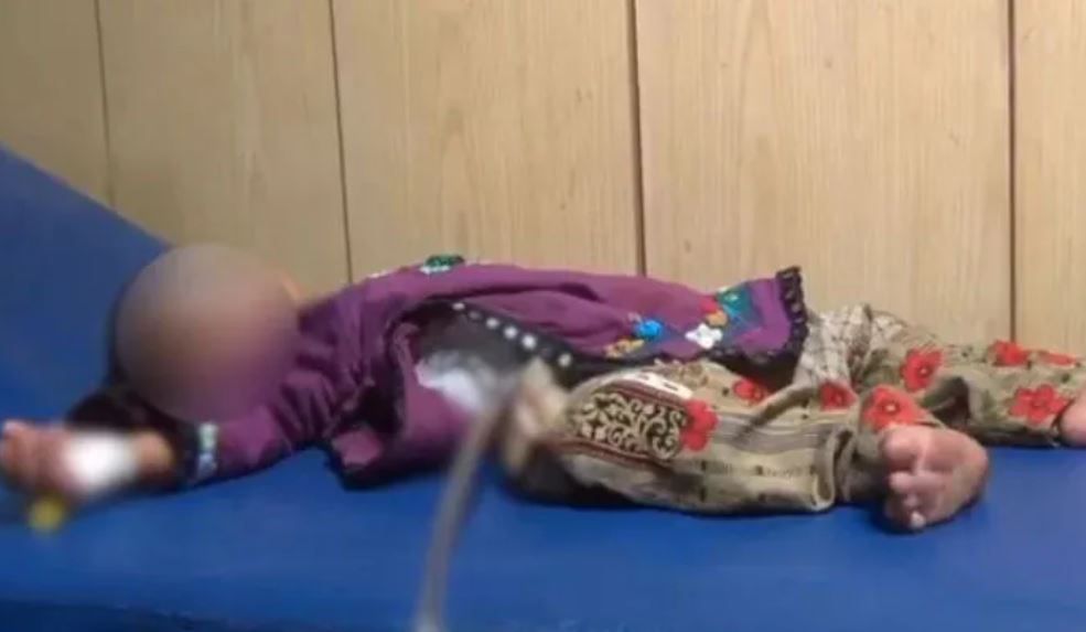 拼盘/吃掉双胞胎!女婴腹痛10月 开刀才知胃里藏“婴儿死胎”